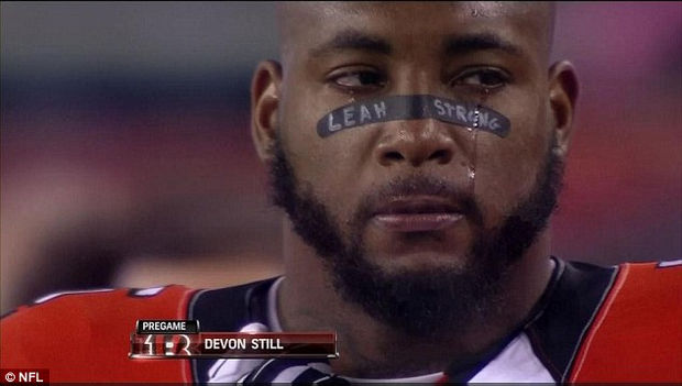 Still showing support for his daughter with “Leah Strong” on his nasal strip. Still fought back tears during the event and the crowd gave him an ovation.