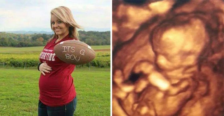 She was also 5 months pregnant at the time but the baby didn't suffer any injuries; therefore, doctors needed to deliver the baby prematurely.
