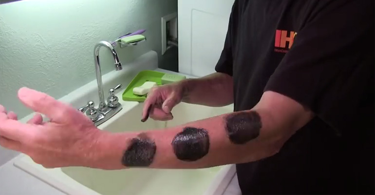 He Rubbed 3 Patches of Oil on His Skin and His Tips Will Crush Your Fears of Poison Ivy