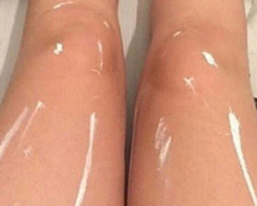Someone Posted Photos of Their Legs and the Internet Is Freaking Out