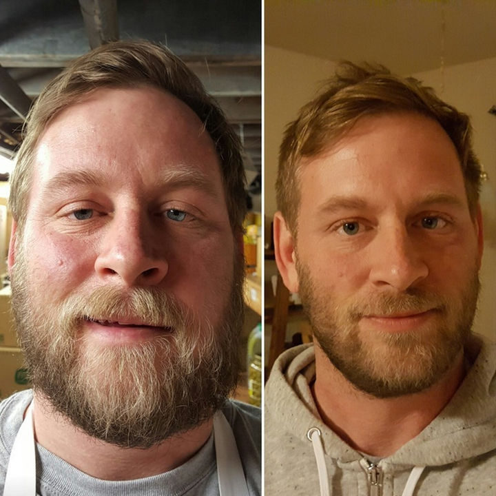 Before and After Weight Loss Photos of People Who Quit Drinking - 7 Months Sober.
