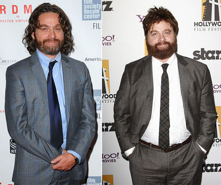 Before and After Weight Loss Photos of People Who Quit Drinking - Even actors like Zach Galifianakis have transformed themselves by quitting alcohol.