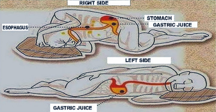 Sleeping on Your Left Side Can Help With Digestion and Prevent Heartburn.