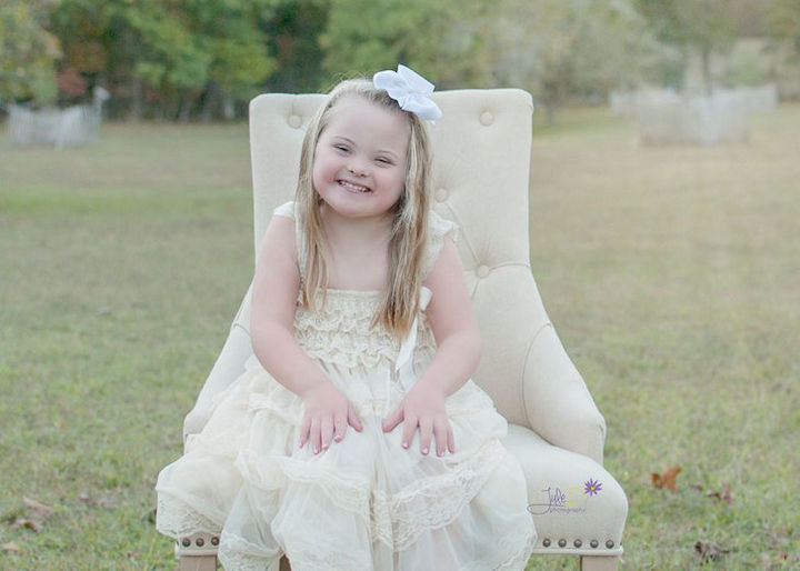 Down syndrome is a genetic disorder caused by the presence of an extra chromosome.