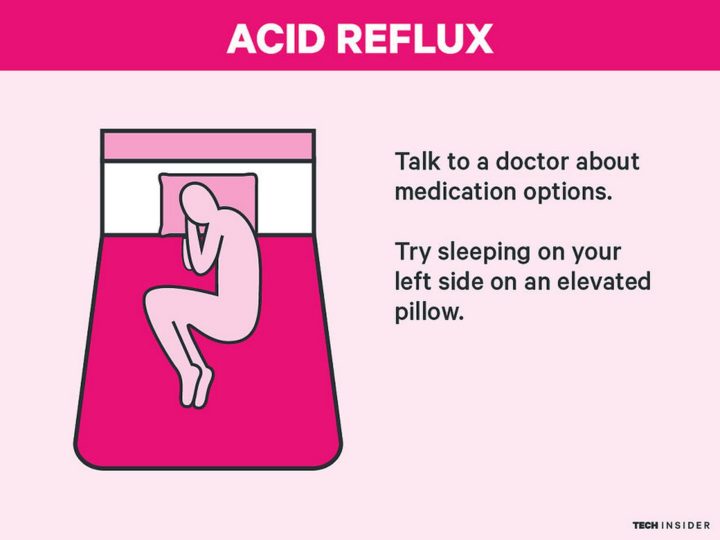 "Acid Reflux: Talk to a doctor about medication options. Also, try sleeping on your left side on an elevated pillow.