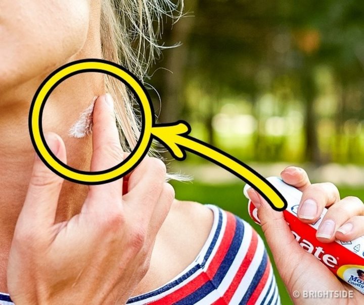 11 Wilderness Survival Tips - Soothe insect bites with a dab of toothpaste.
