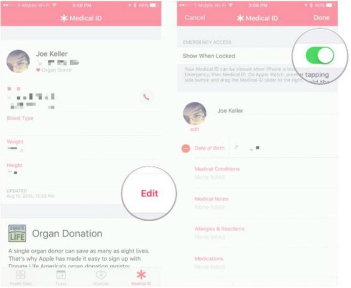 You'll want to ensure that 'Show When Locked' is enabled so that your medical ID can be viewed even if your iPhone is locked.