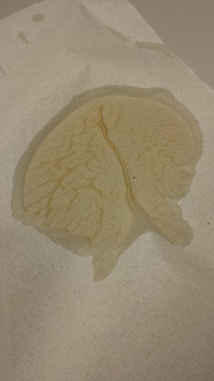 "My coffee spill clean-up looks like a brain."