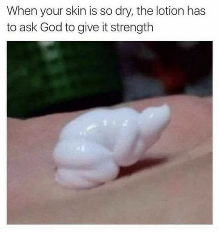 "When your skin is so dry, the lotion has to ask God to give it strength."