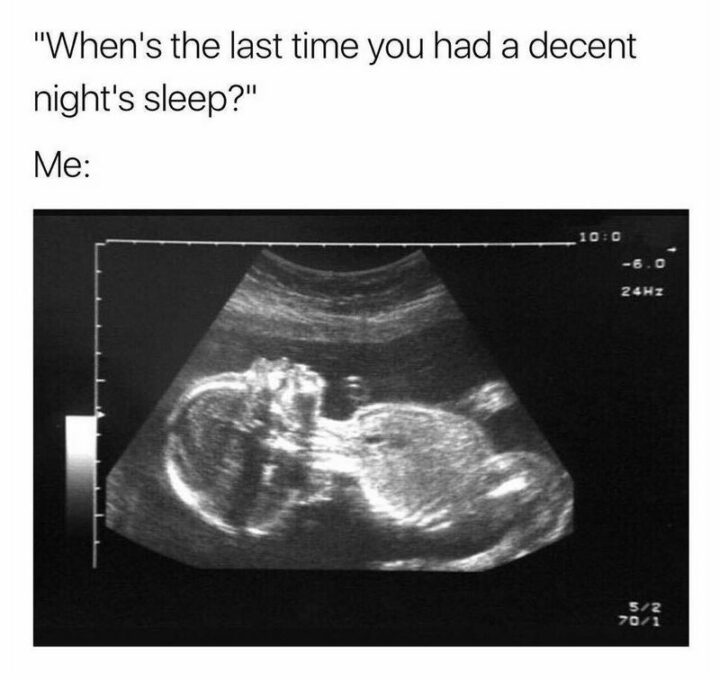 "When's the last time you had a decent night's sleep? Me:"